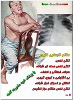  نارسایی  قلبی  یعنی  کاهش  شدید  عملکرد  قلب.  به  این  معنی  که  قلب  نمی  تواند  خوب  خون  را  پمپاژ  کند.  شایعترین  علت  نارسایی  قلب،  بیماری  های  ایسکمیک  قلب  است  که  به  دنبال  انسداد  شریان  های  قلبی  در  اثر  وجود  پلاک  و  سکته  ی  قلبی  ایجاد  می  شود. 