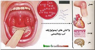  عفونت  های  استرپتوکوکی  را  بخصوص  در  افراد  پنج  تا  پانزده  ساله  جدی  بگیرید.  چرا  که  در  افراد  مستعد  به  راحتی  می  توانند  صدمات  جدی  ایجاد  کنند. 